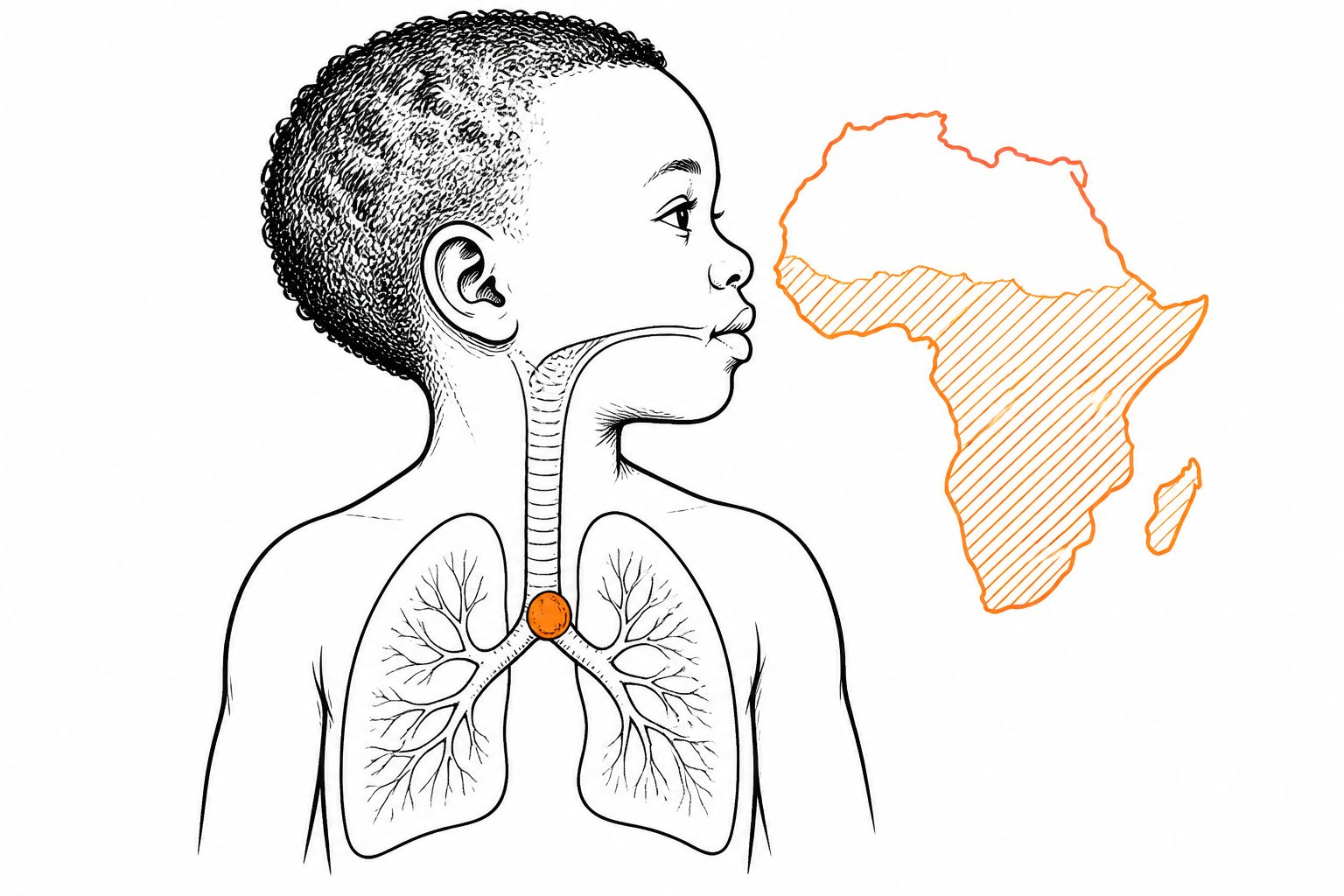 Abstract editorial illustration accompanying the article: Review reports regional differences in children who inhale foreign objects in sub-Saharan Africa